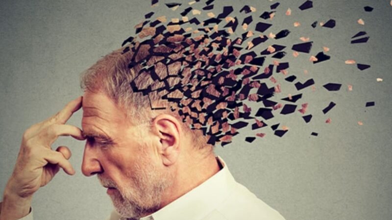 El Alzheimer es una enfermedad neurodegenerativa que afecta a millones de personas